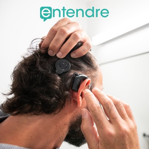 Qu'est-ce qu'un implant cochléaire ?
