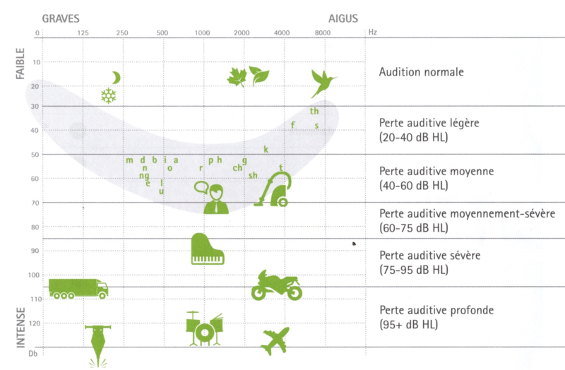 PERTE D'AUDITION